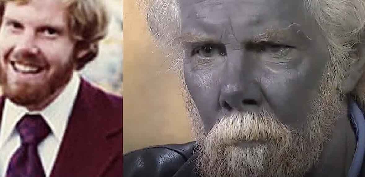 This guy drank homemade colloidal silver for 20 years and turned blue-indigo.jpg