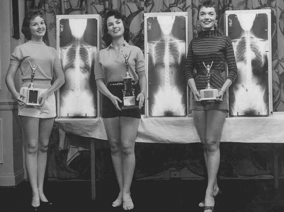 1st, 2nd and 3rd Place in the Miss Correct Posture Contest pose with trophies and their X-rays (1956).jpg
