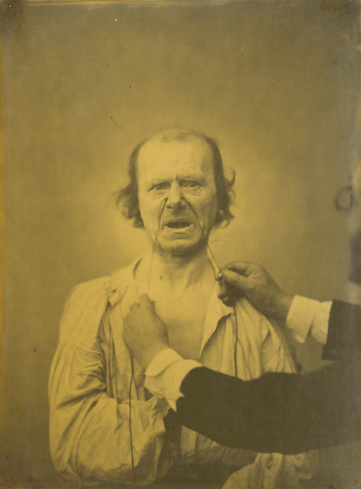 Experiments-in-facial-expressions-by-Guillaume-Benjamin-Amand-Duchenne-de-Boulogne-18.jpeg