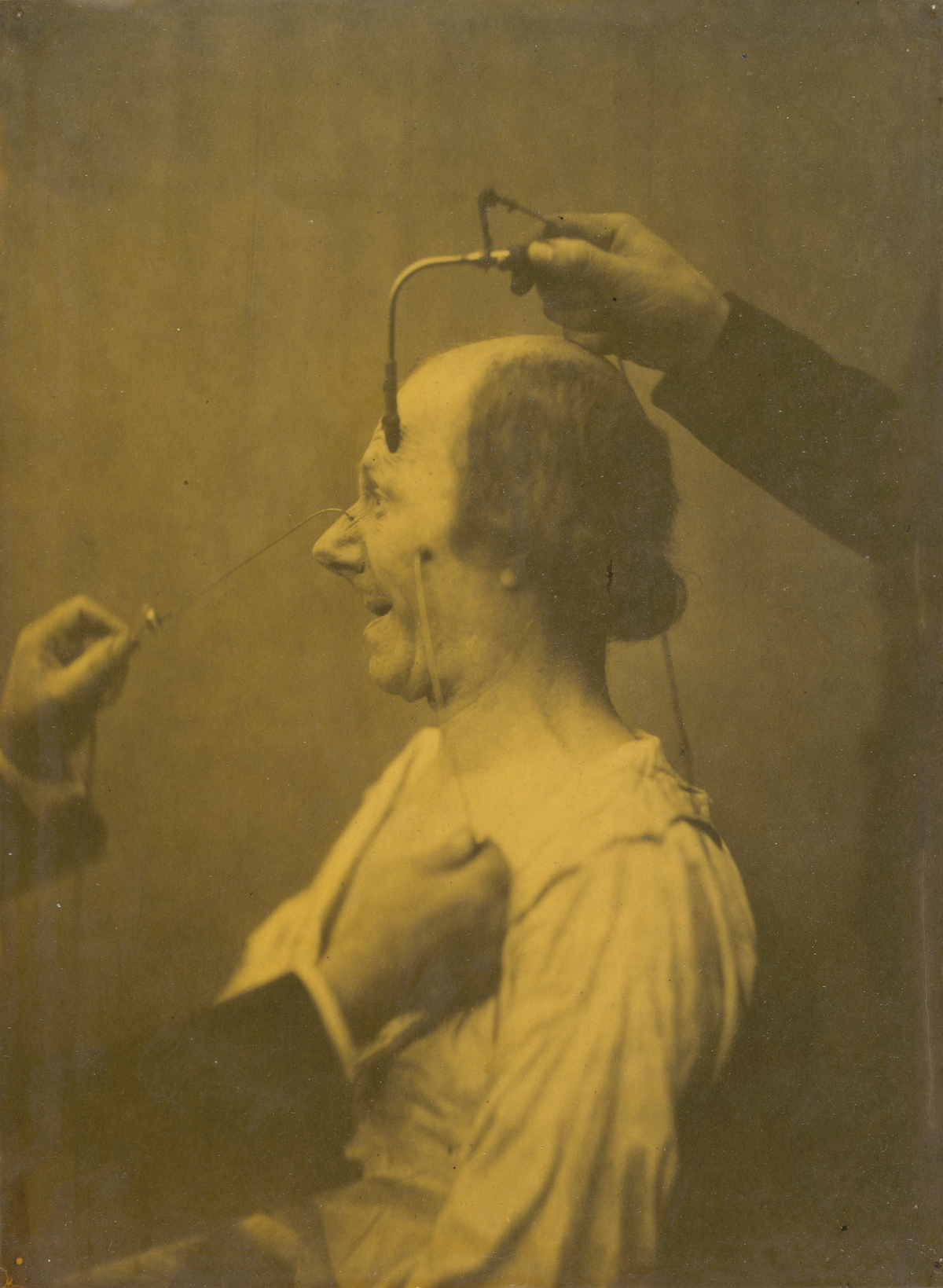 Experiments-in-facial-expressions-by-Guillaume-Benjamin-Amand-Duchenne-de-Boulogne-37.jpeg