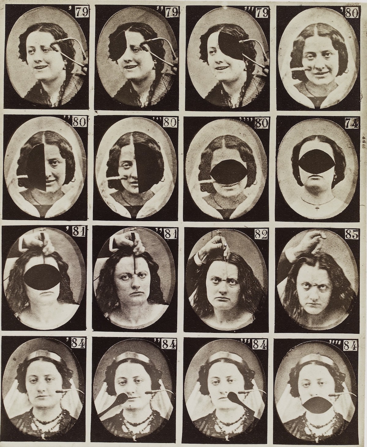 Experiments-in-facial-expressions-by-Guillaume-Benjamin-Amand-Duchenne-de-Boulogne-51.jpg