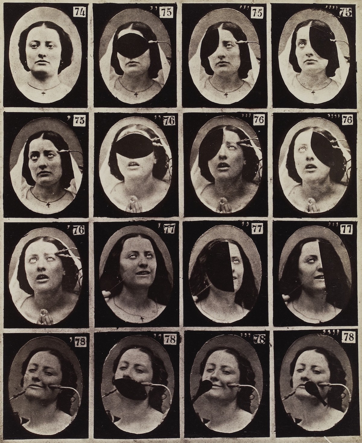 Experiments-in-facial-expressions-by-Guillaume-Benjamin-Amand-Duchenne-de-Boulogne-50.jpg