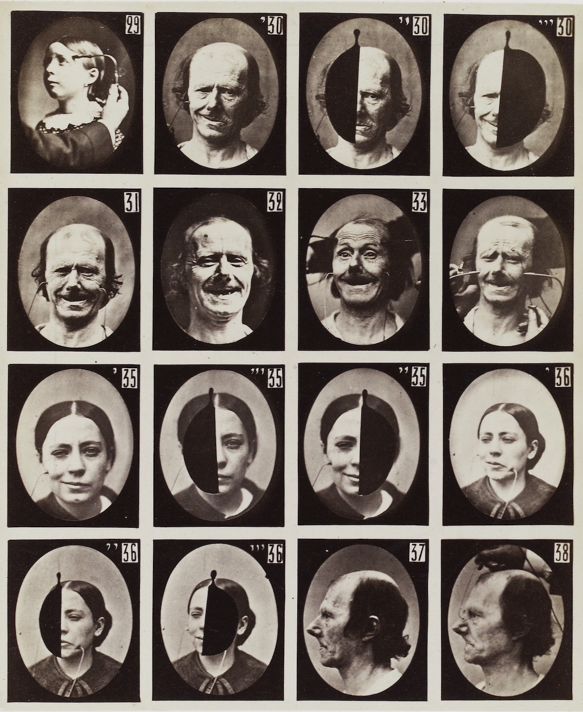 Experiments_in_physiology._Facial_expressions_Wellcome_L0037793.jpg