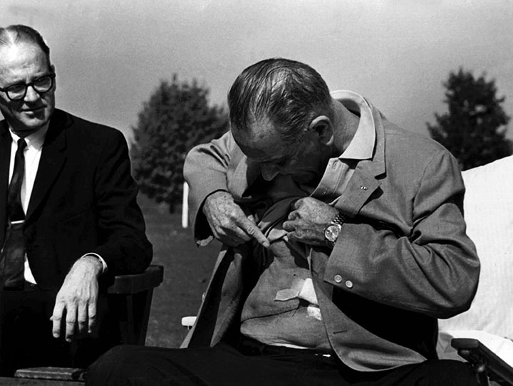President Johnson lifting his shirt to show the scar from surgery on October 8, 1965.jpg