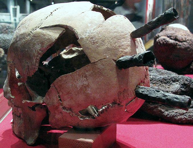 A skull with three crossbow bolt wounds from the Battle of Visby, Gotland, in 1361. Many of the dead were buried in their armor because of mass casualties and the hot weather led to fast decomposition.jpeg