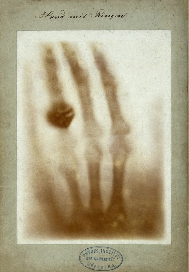 Bertha Rontgen's hand, December 22, 1895. The first X-ray image taken of a human being.JPG